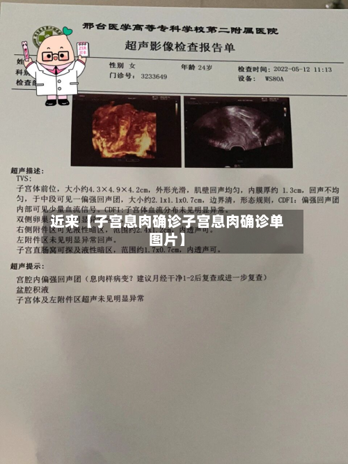 近来【子宫息肉确诊子宫息肉确诊单图片】