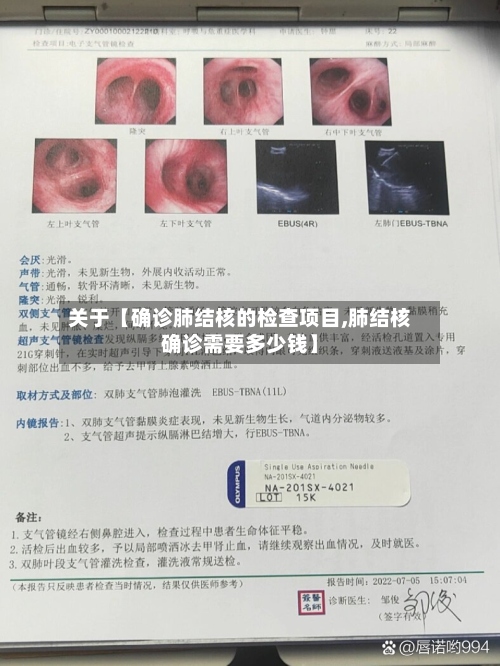 关于【确诊肺结核的检查项目,肺结核确诊需要多少钱】