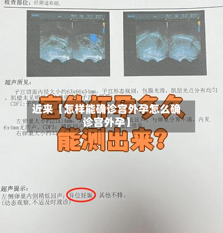 近来【怎样能确诊宫外孕怎么确诊宫外孕】