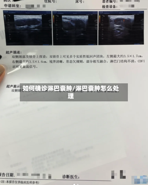 如何确诊淋巴囊肿/淋巴囊肿怎么处理